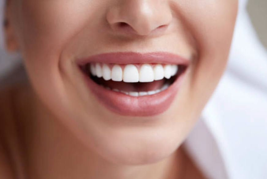 Teeth Whitening - Aezthetic